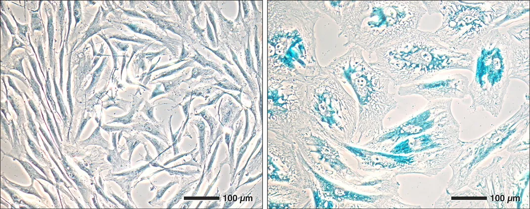 Could Getting Rid of Old Cells Help People Live Disease-Free for Longer?