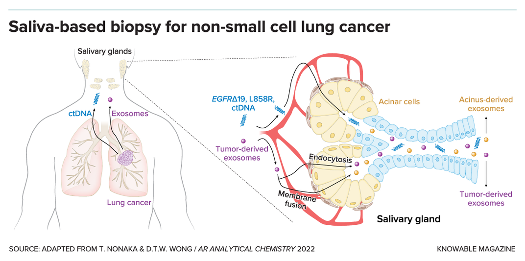 Is Saliva the Next Frontier in Cancer Detection?